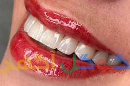 دندانپزشکی تبریز