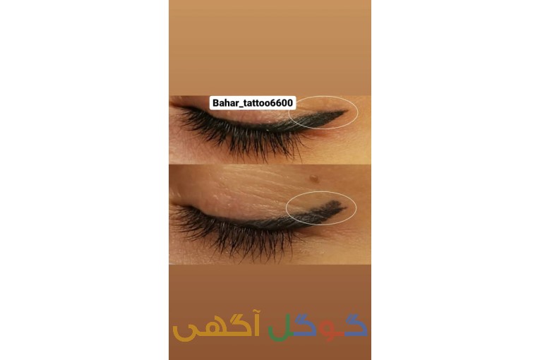 ریموو ابرو/خط لب/خط چشم