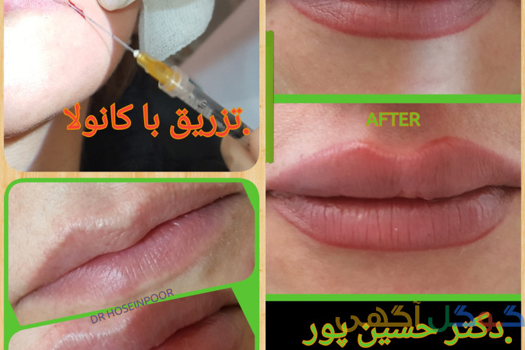 مطب پوست و مو و زیبایی و لیزر موی زائد دکتر رضا حسین پور بهارستان اصفهان 