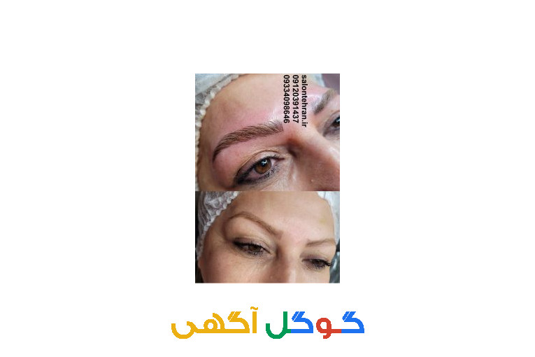 مرکز فیبرز ابرو در ستارخان