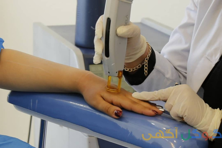 لیزر بوتاکس ژل