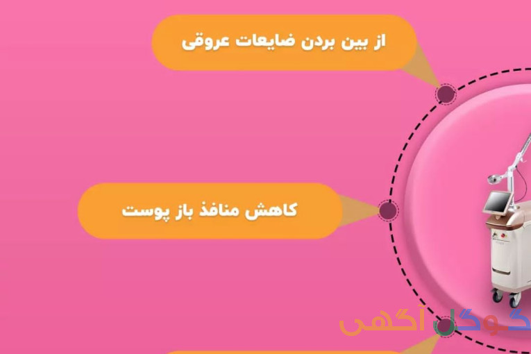 کلینیک تخصصی پاک کردن و ریموو تاتو با لیزرکیوسوئیچ هلیوس و آراف فرکشنال