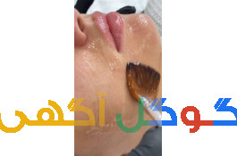 پاکسازی و فشیال تخصصی 
