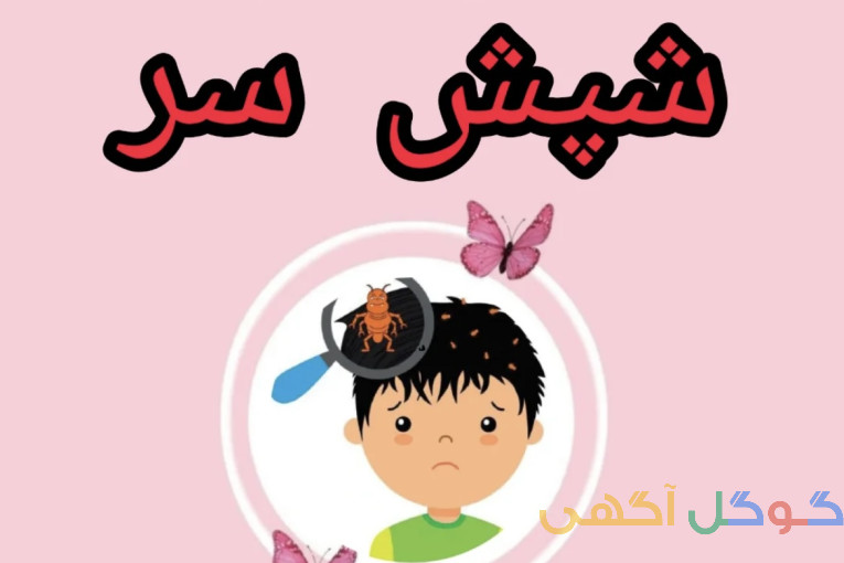 درمان رشک و شپش تضمینی