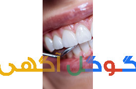 خدمات دندانپزشکی 
