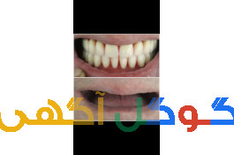 دندانسازی حسین پور