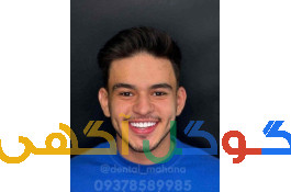 جشنواره کامپوزیت  اقساط کرج دندانپزشکی ماهانا