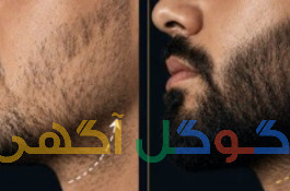 رویش ریش ظرف مدت 30روز تضمینی 