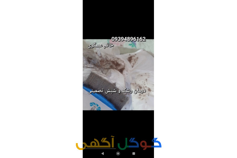پاکسازی شپش سر