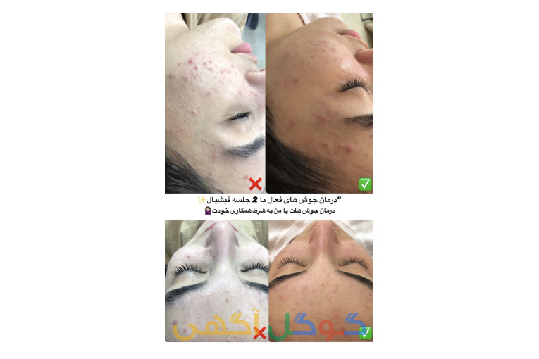 فیشیال تخصصی پوست