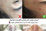 فیشیال تخصصی پوست