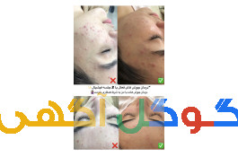 فیشیال تخصصی پوست